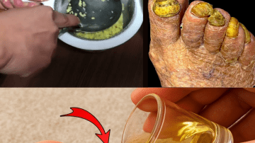 No Medicine, No Worry: 97-Year-Old Woman’s Steamed Ginger Recipe for Longevity