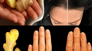 Ginger and Oil Remedy: Traditional Treatment Support for Toenail Fungus
