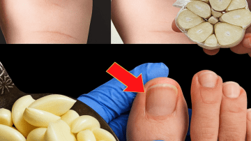 Cloves vs. Garlic: Which Spice Packs More Punch for Your Health?