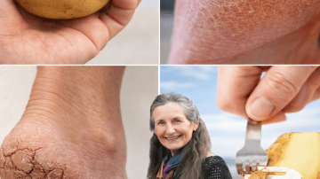 ALERT! 7 STRANGE Signs Your Kidneys Are Crying for Help – Don’t Wait Until It’s Too Late