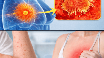 12 Moringa Seed Benefits You’ll Never Hear from Your Doctor (But You Should Know)