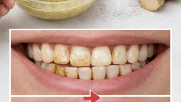 With Just Toothpaste and Lemon – The Results Will Surprise Everyone… But Not Always in the Way You Expect