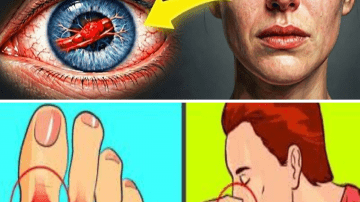 Top 4 Best Morning Drinks That Will Flush Out Toxins and Save Your Kidneys