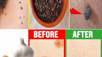 Warning: 8 Common Medications That Could Raise Your Heart Attack Risk