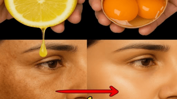 High Creatinine Levels? Unlock 3 Safe Vitamins to Embrace and 3 to Steer Clear Of