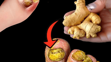 Healing Kidneys Naturally with Herbal Leaves: Supportive Strategies