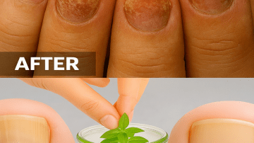 Top 9 Bedtime Habits That Can Lower Creatinine and Shield Your Kidneys Overnight