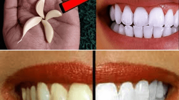 This Tea Heals Veins and Stops Leg Pain Fast!