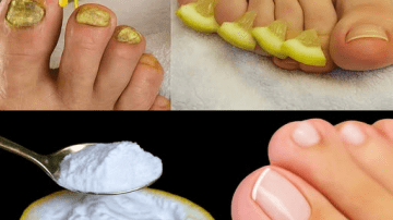 5 Ways Onion and Vaseline Combat Aging Hands Naturally