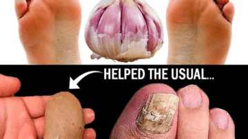 5 Ways Onion and Vaseline Combat Aging Hands Naturally