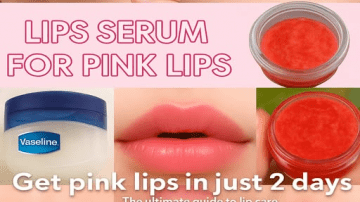 Ginger and Garlic Remedy for Varicose Veins and Leg Circulation