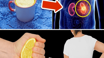 Garlic Remedy for Natural Hair Removal (Before & After)