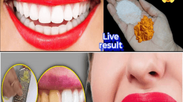 Seniors: The Vitamin That Helps Protect Against Leg Blood Clots