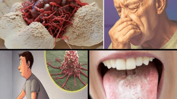 Get Your Kidneys Back and Stop Proteinuria in 7 Days With These 5 Simple Drinks!