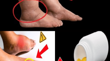 10 Warning Signs of Blocked Heart Arteries In Legs and Feet (Don’t Ignore These Signals)