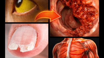 Cloves After 60: 2 Cloves a Day for 7 Days – Big Changes (Not What You Think)