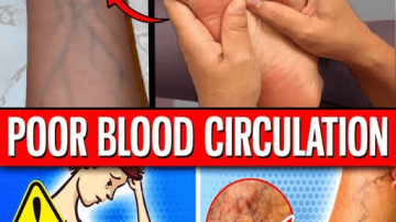 The Best Vitamin to Improve Blood Circulation in Your Legs and Feet After Age 50