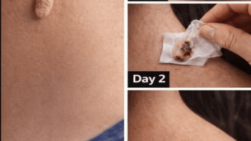 The #1 Supplement Emerging for Blood Sugar Support in Diabetics