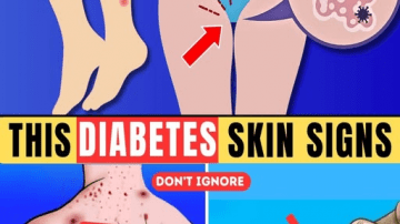 Urologist Shocked: 11 Surprising Health Benefits of L-Citrulline You Need to Know