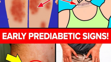 This Ginger, Lemon & Garlic Drink Is Getting Attention for Eye Wellness