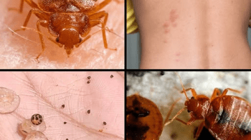 Mix Black Seed Oil and Honey: Nature’s Powerful Daily Ritual You Might Be Missing