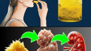 9 Warning Signs Your Kidneys Are Failing — And Simple Tests That Could Help Avoid Dialysis