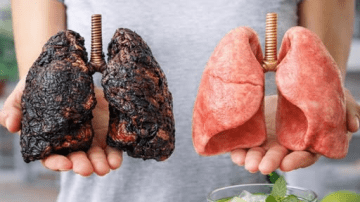 Top 3 Ways to Treat Tooth Decay with Guava Leaves – Simple and Cost-Effective