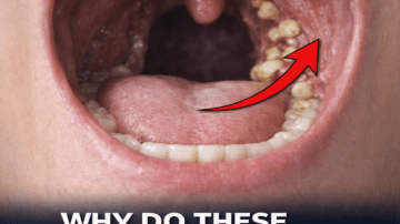 The Most Powerful Herbs to Help Fight Dangerous Blood Clots in the Legs – What Science Suggests About Nature’s Supportive Allies