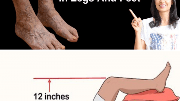 Discover What Your Skin Reveals About Diabetes Before Any Blood Test