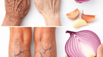 Collagen Oil: Could This Simple DIY Blend with Baby Oil and Cloves Support Softer, More Youthful-Looking Skin?