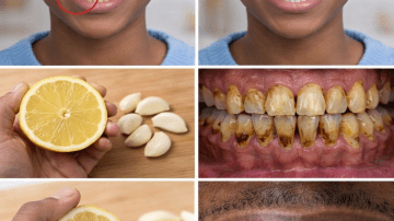 Mix These 3 Ingredients Before Bed: Support Your Arteries While You Sleep