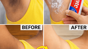 Forget the Hype! This Homemade Baking Soda Cream Will Make Your Skin POP – Seriously, Glow Like You’re 35 at 65!